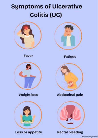 “Symptoms of Ulcerative Colitis (UC)” showing six symptoms: fever, fatigue, weight loss, abdominal pain, loss of appetite and rectal bleeding, each represented with simple illustrations.